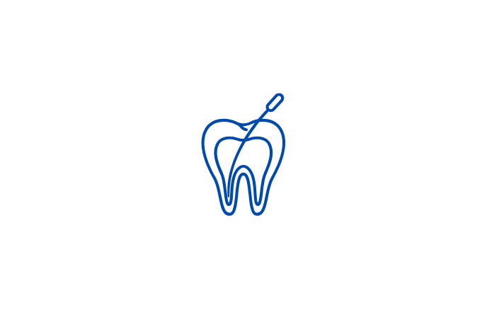 Root canals 